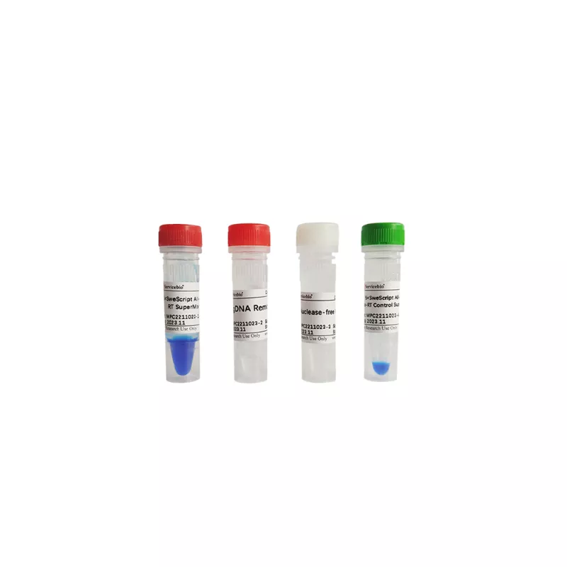 Servicebio SweScript All-in-One Blue RT SuperMix for qPCR (One-Step gDNA Remover)