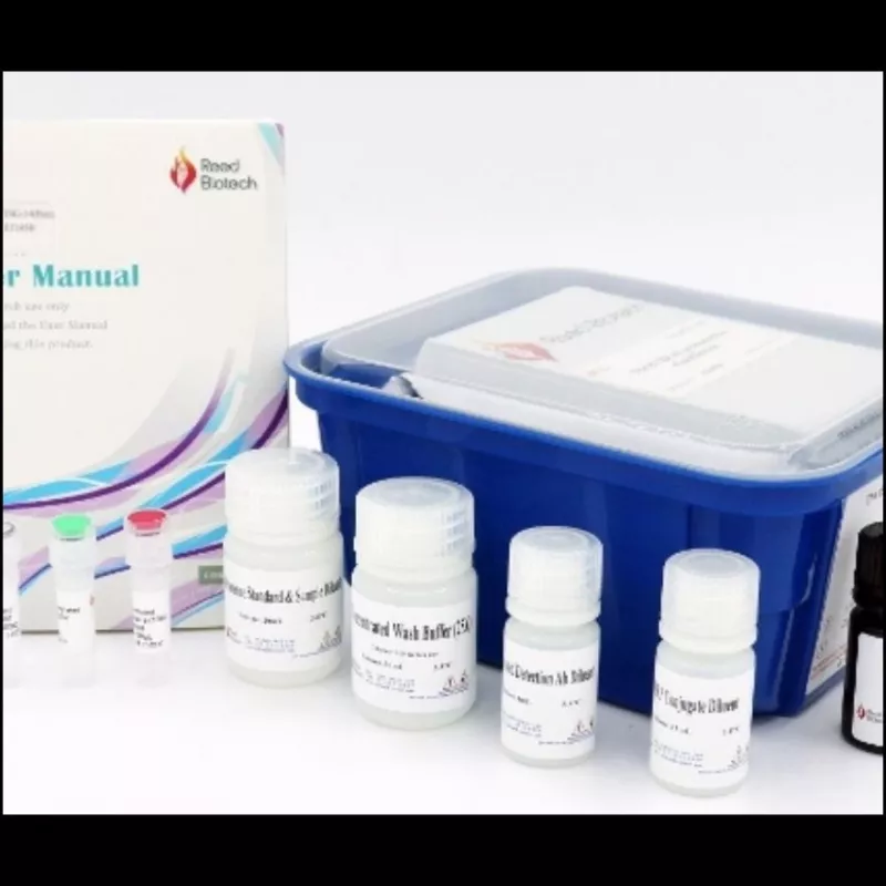 Reedbiotech Human HMGB-1(High Mobility Group Protein B1) ELISA Kit
