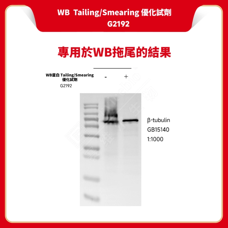 Servicebio WB sample Tailing/Smearing 優化試劑