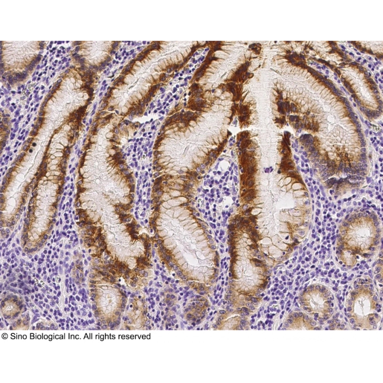 Anti-RON/MSP receptor Antibody, Rabbit Polyclonal