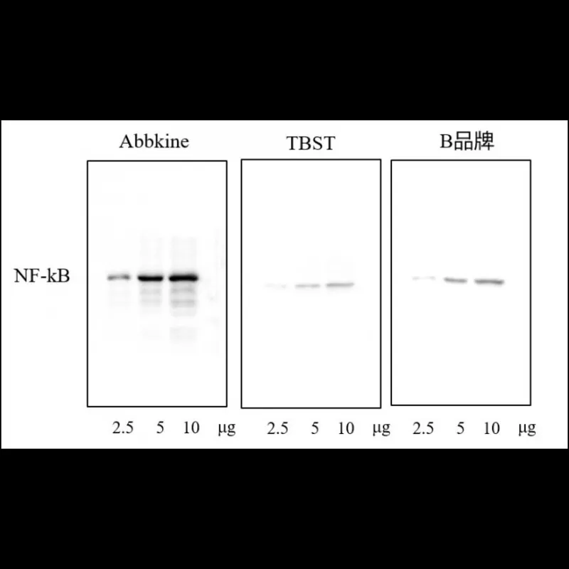 Abbkine SuperKine™ Enhanced Antibody Dilution Buffer